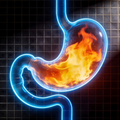 Reflux